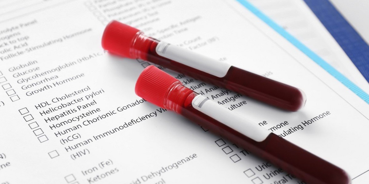 Ureaplasma Test: Common Myths vs. Medical Facts