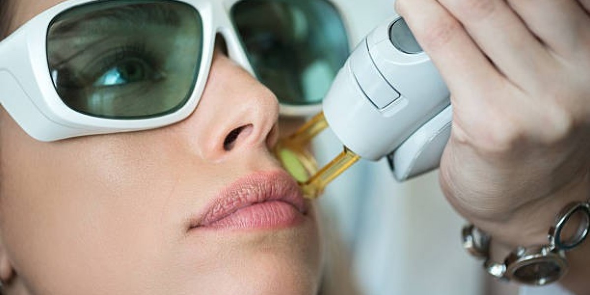 Benefits of Choosing Electrolysis Hair Removal in Riyadh