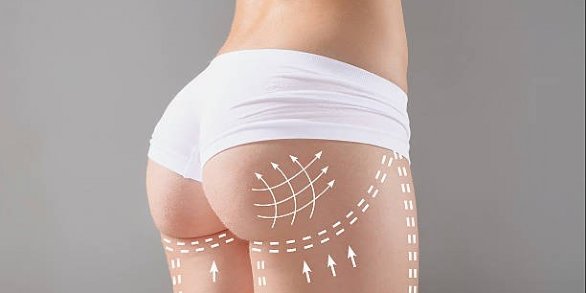 Exploring Mommy Makeover in Riyadh for Personalized Body Enhancement